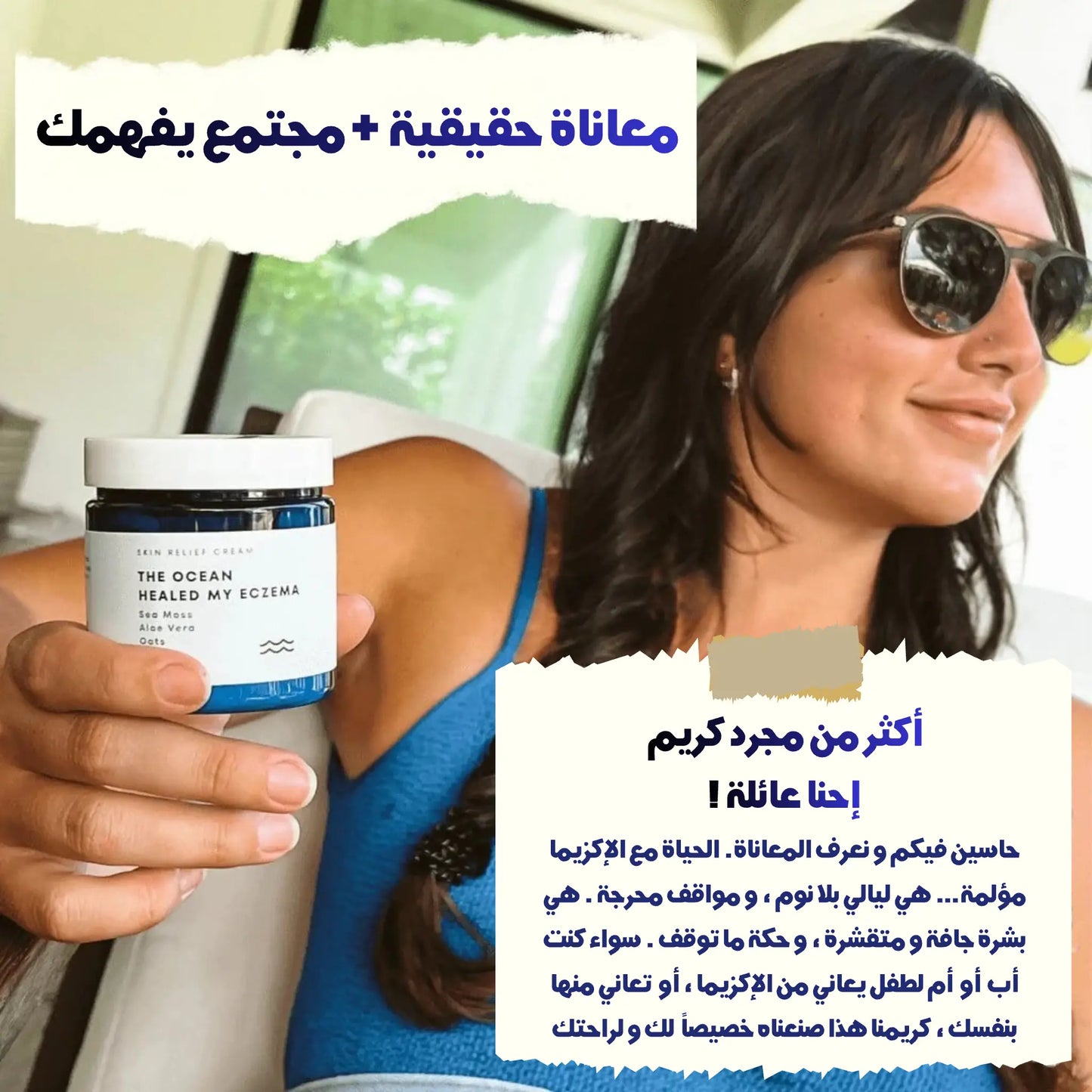 eczema topical cream